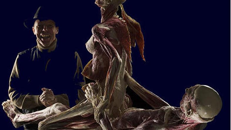 Günther von Hagens je zaradi svojega dela naletel na številna neodobravanja in c