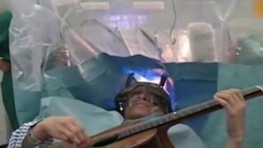 operacija možgani kitara