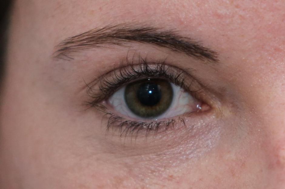 dermaluxelash, trepalnice | Avtor: Saša Despot