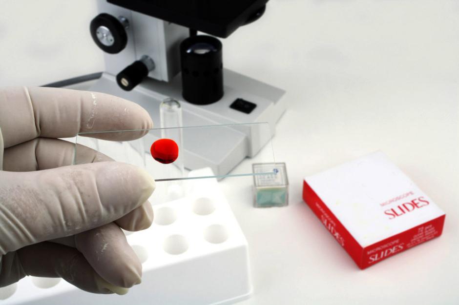 Zivljenje 20.11.07...AIDS...krvni...test...mikroskop......foto: Istockphoto | Avtor: iStockphoto