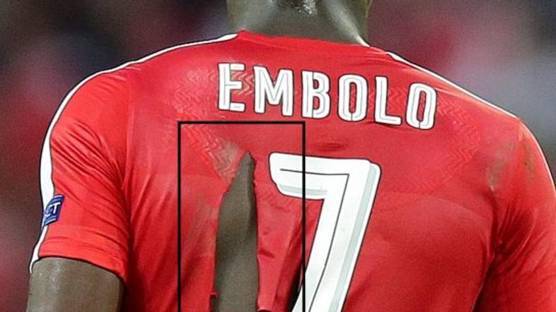 embolo