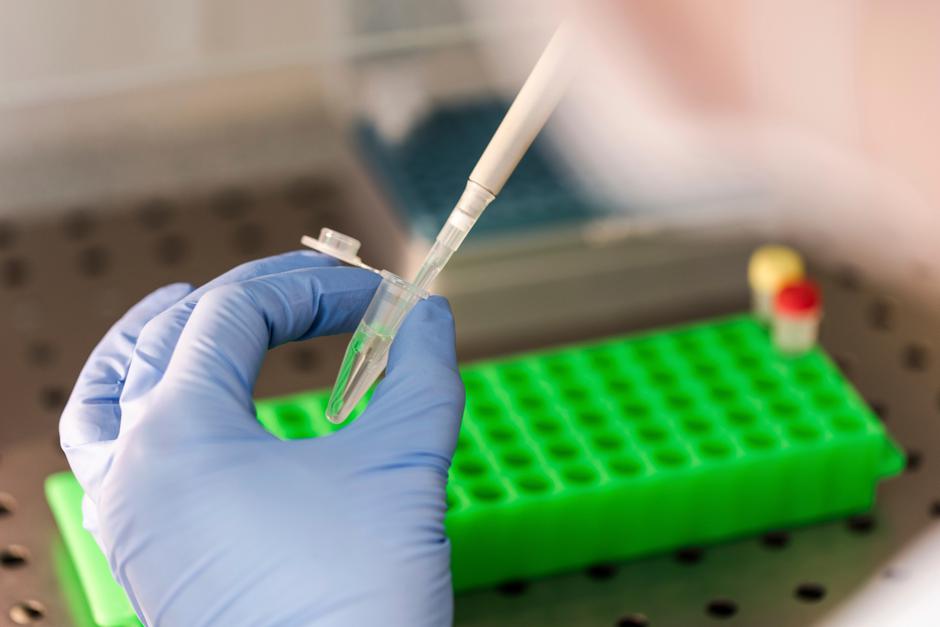 Covid-19 | Avtor: Profimedia