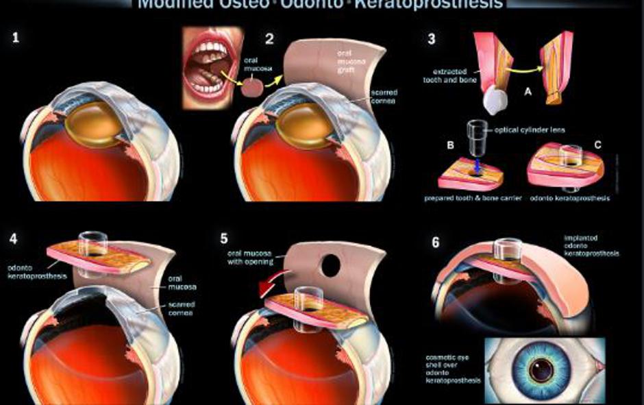 Operacija oči | Avtor: Žurnal24 main