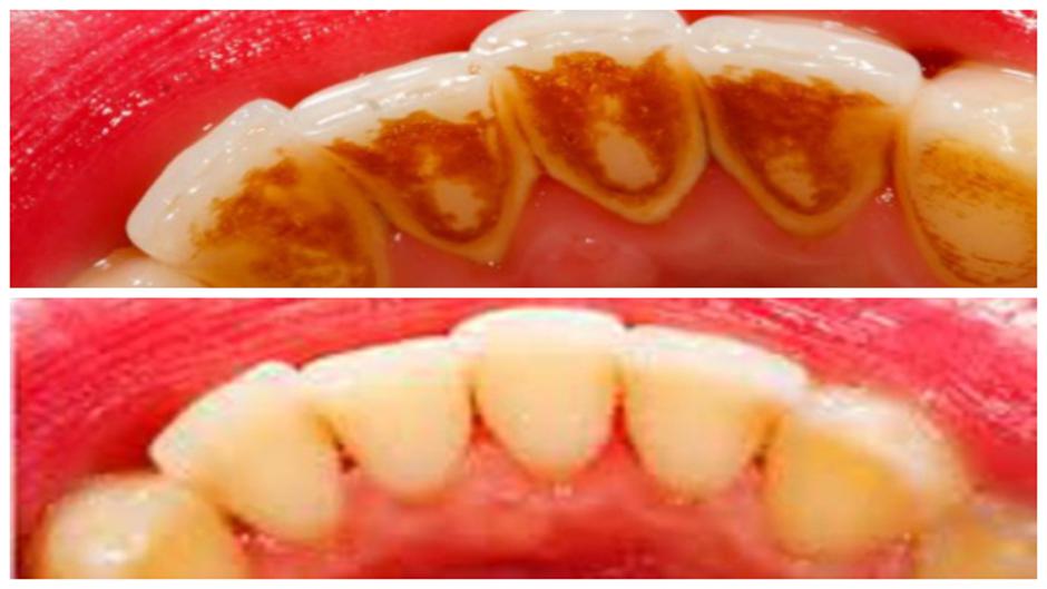 Zeodent® | Avtor: PETRAM-promet d.o.o.