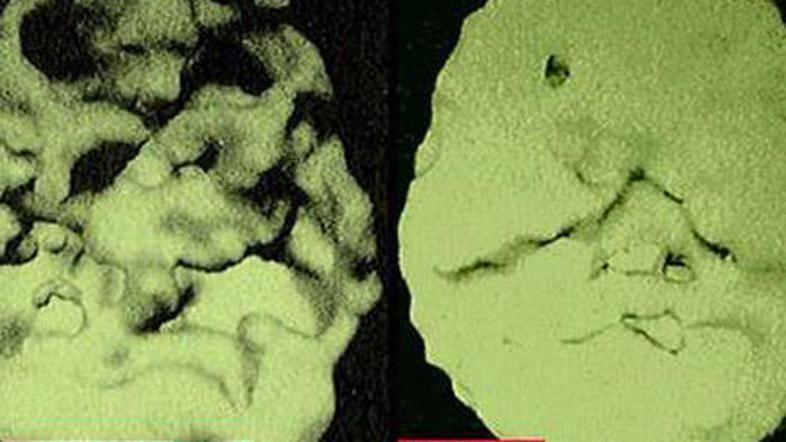 Ste še prepričani, da kajenje ne škoduje vašemu zdravju?