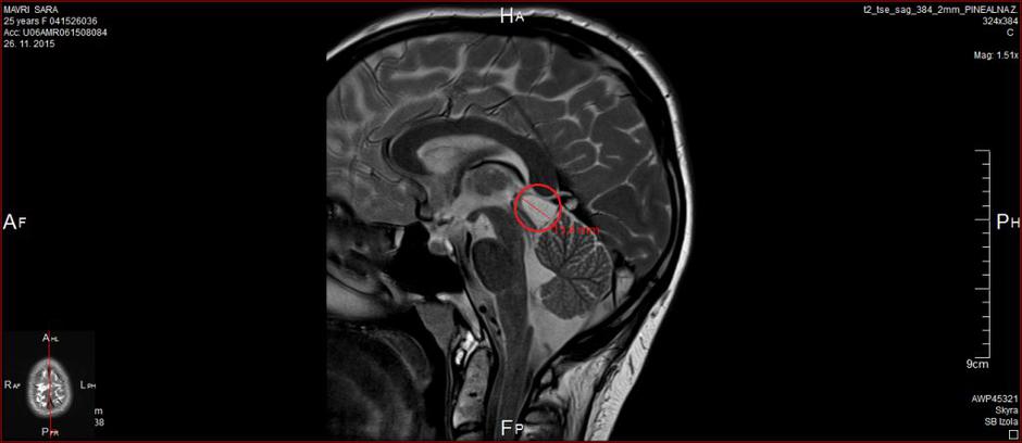 Sara slika glave | Avtor: Andreja Cilenšek