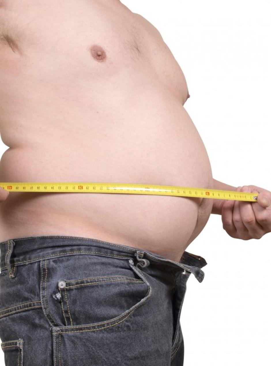 debelost | Avtor: Profimedias