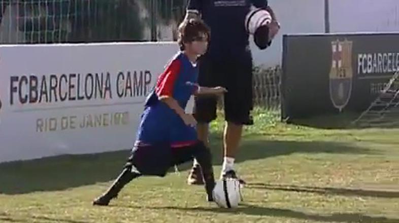 deček brez nog brazilija gabriel