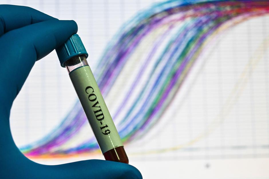 Covid-19 | Avtor: Profimedia