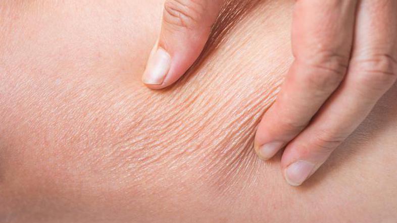 Kolagen DELUJE! Vendar ne storite te usodne napake!