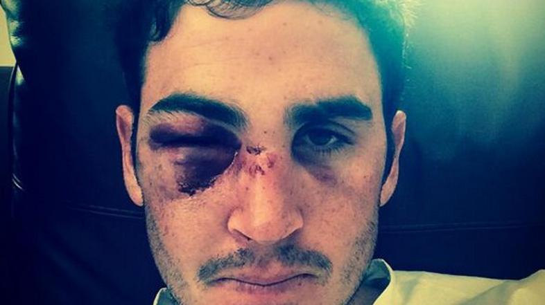 Craig Kieswetter
