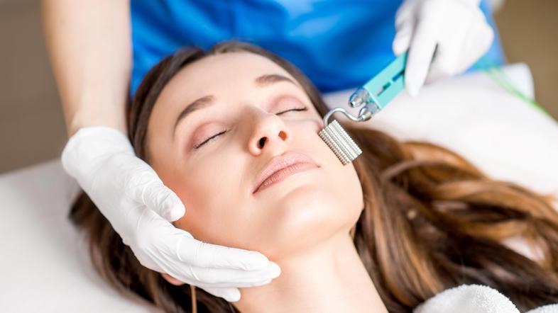 Microneedling