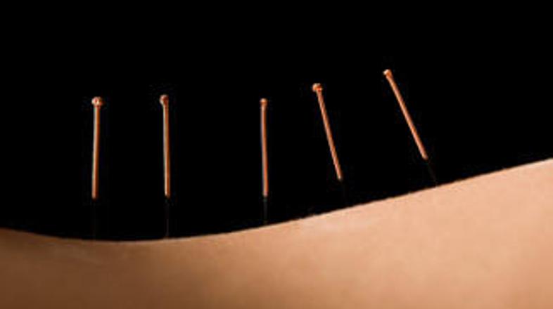 Če imate težave s suho ustno votlino, bi vam morda pomagala akupunktura.