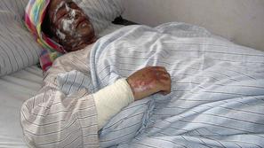 dekle, polito s kislino