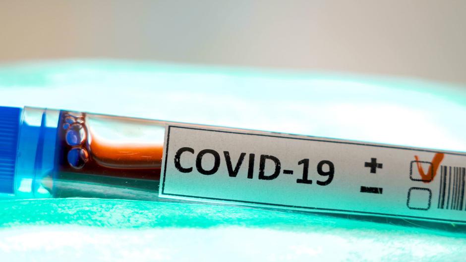 Covid-19 | Avtor: Profimedia