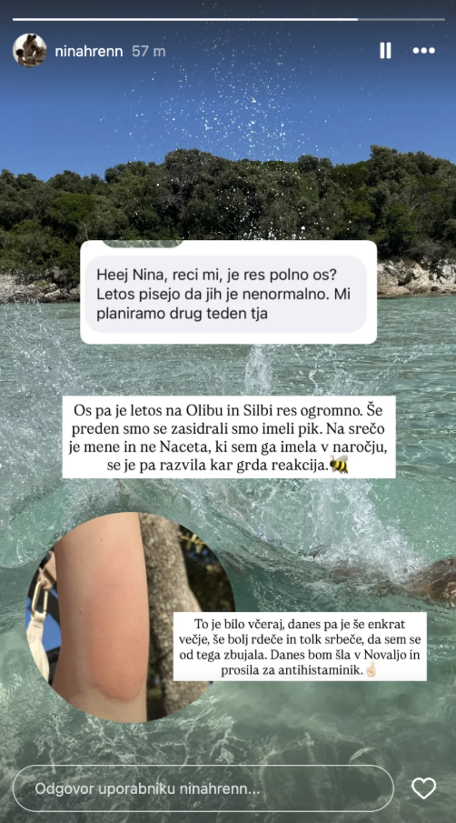 Piki os | Avtor: Instagram/Nina Hren/posnetek zaslona