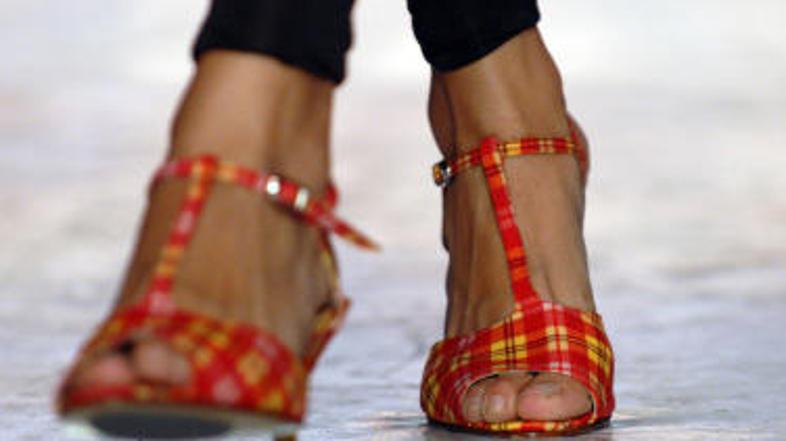 Neprijetno otekanje nog lahko ublažite z redno telesno vadbo.