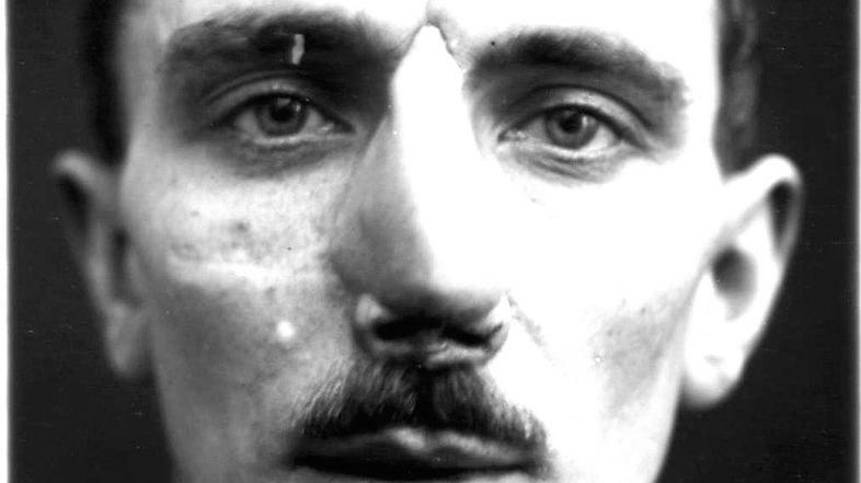 Plastične operacije