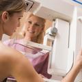 mamografija