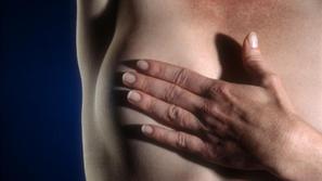 Za rakom na dojkah najpogosteje zbolevajo ženske med 50. in 70. letom.