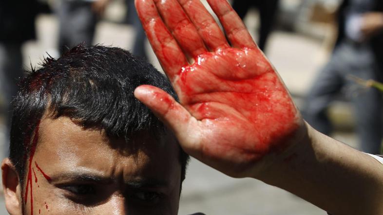 Jemen zadnje tedne pretresajo protesti nezadovoljnih državljanov, ki zahtevajo s