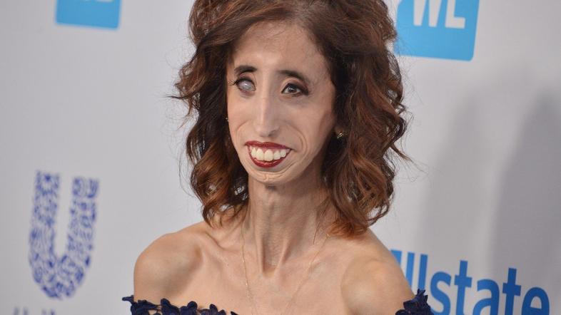 Lizzie Velasquez