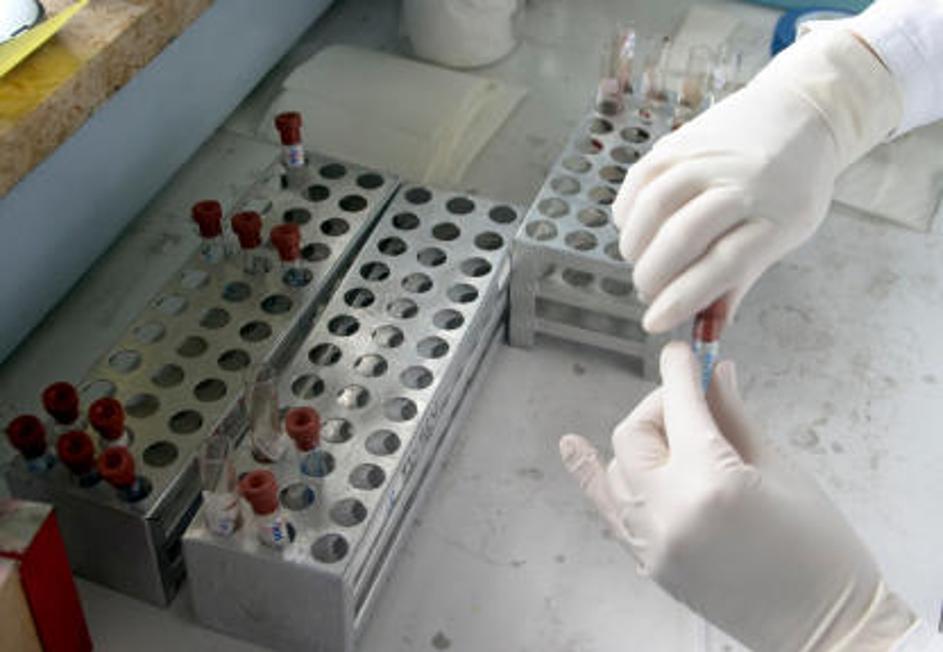 Laboratorij HIV AIDS epruvete iStock