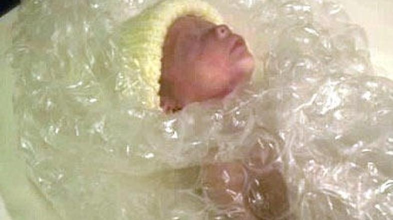 Vrečka se je obrestovala, prezgodaj rojeni Gregor je preživel.