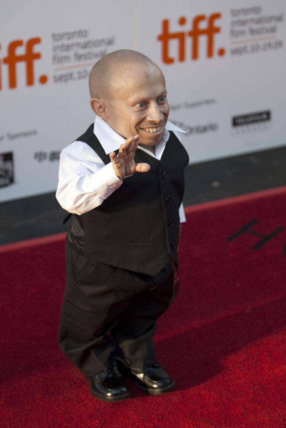 Verne Troyer (1. januar 1969) | Avtor: Žurnal24 main