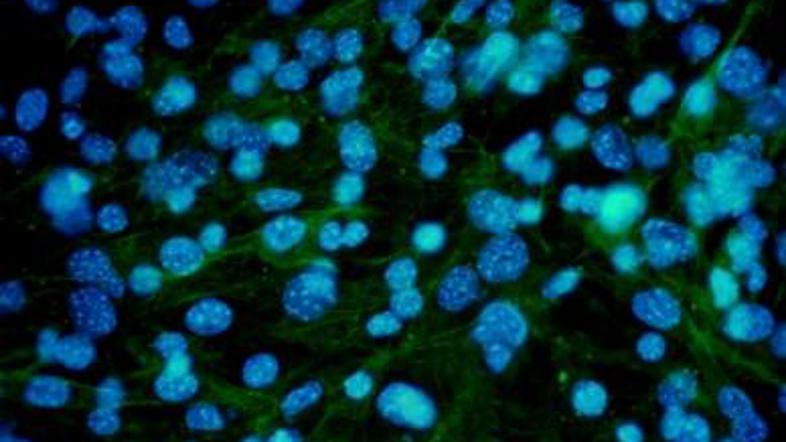 Z manipulacijo genov lahko znanstveniki vplivajo na delitev kožnih celic.