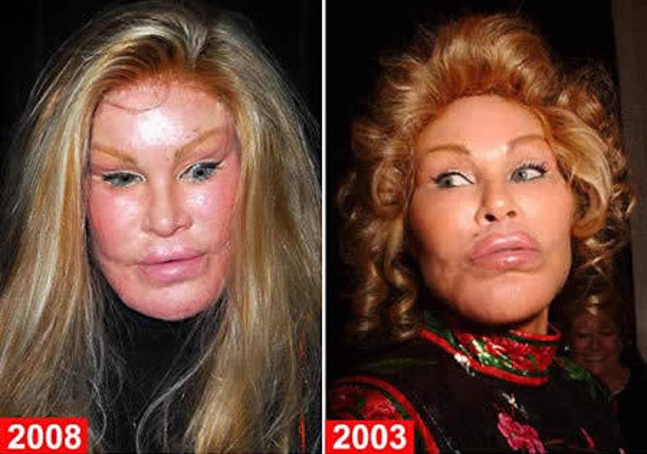 Jocelyn Wildenstein | Avtor: Žurnal24 main