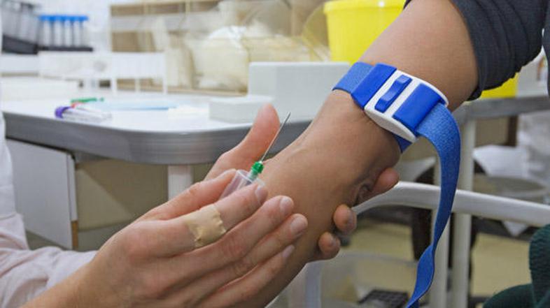 Zanimanje za testiranje na virus HIV je v Sloveniji še vedno nizko. (Foto:) Shut