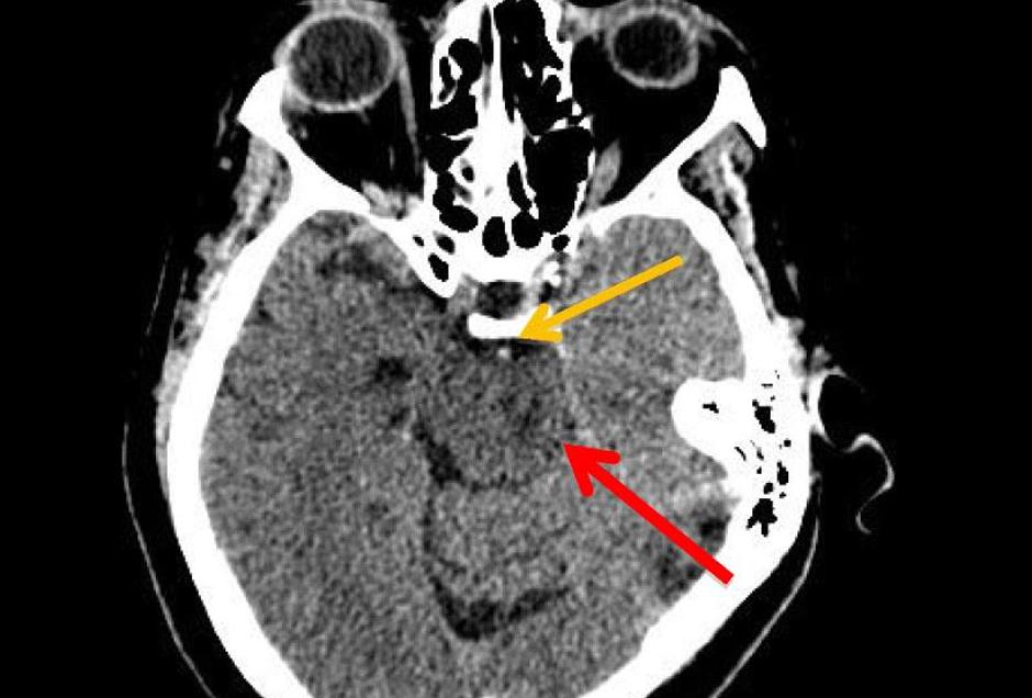  | Avtor: BMJ