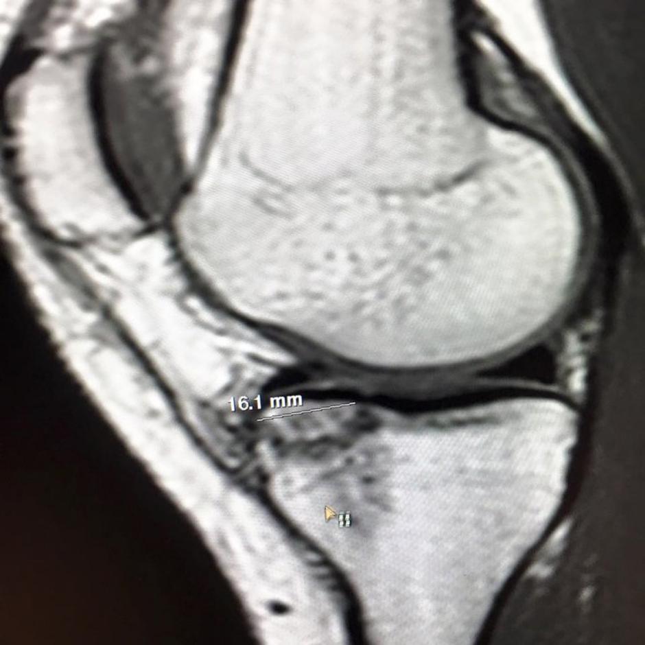 lindsey vonn MRI | Avtor: EPA