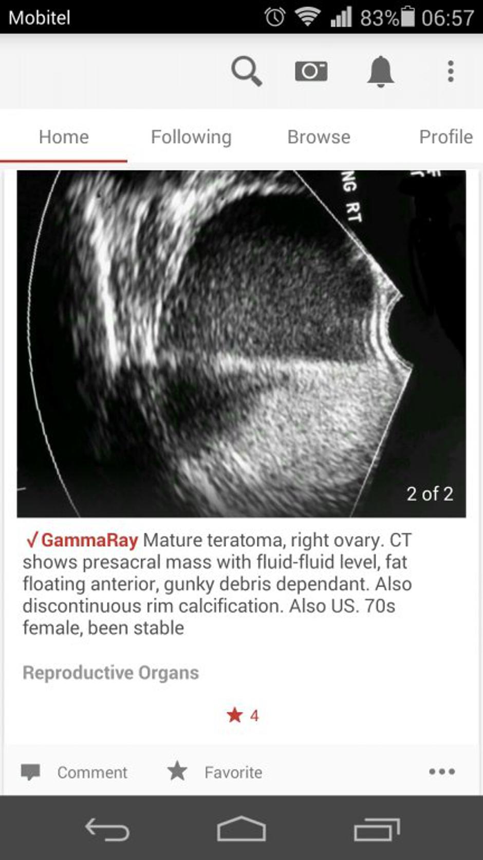 App | Avtor: Print screen