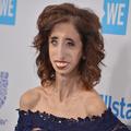 Lizzie Velasquez