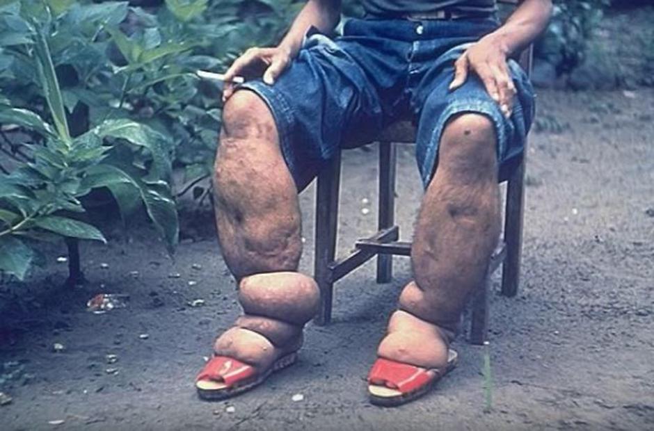 Elefantiaza | Avtor: Animal Planet