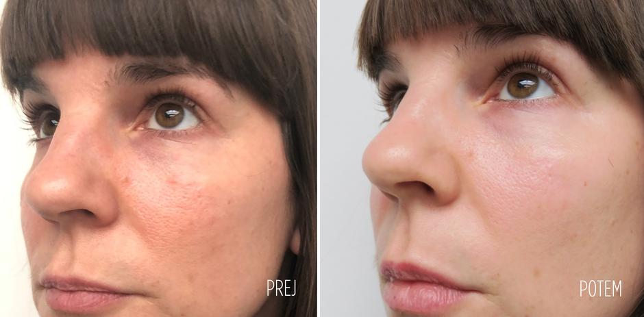 Medex | Avtor: Medex