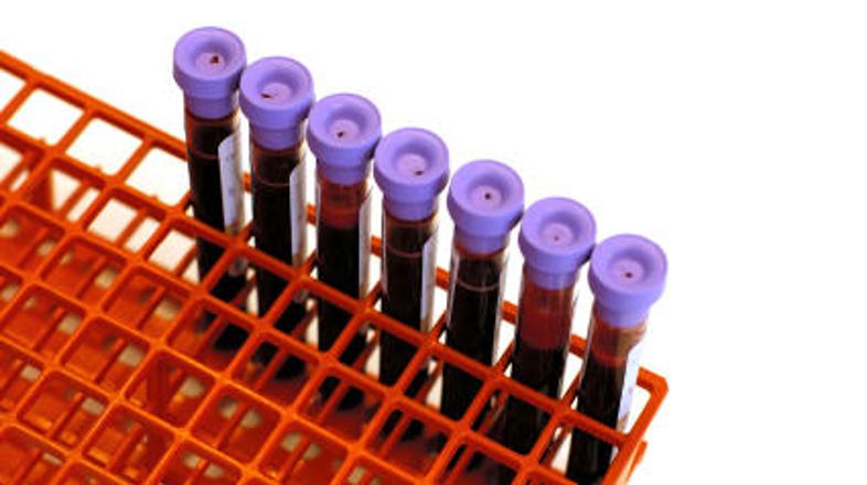 Najmanj zaželena krvna skupina na Japonskem je B. Njeni pripadniki naj bi bili p