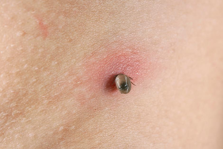 Klopi in bolezni | Avtor: Profimedia