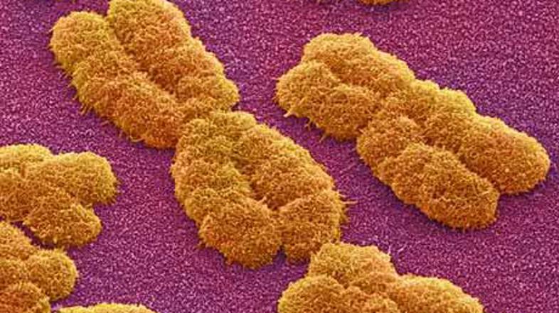Povečevanje količine encima v telesu preprečuje staranje kromosomov.