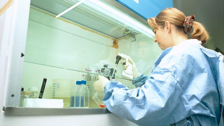 virus HIV raziskava laboratorij