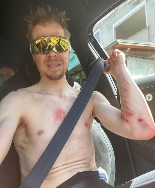 Poškodbe Jana Tratnika