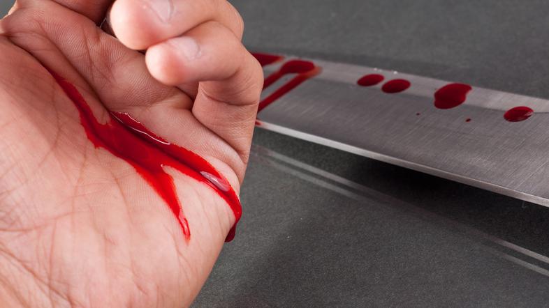 (Foto: Shutterstock)