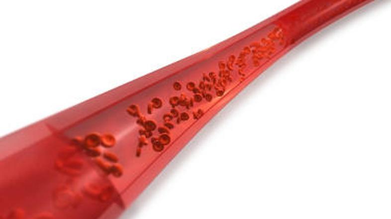 Preprečevanje venske tromboze temelji na dveh načelih: zaviranje strjevanja krvi