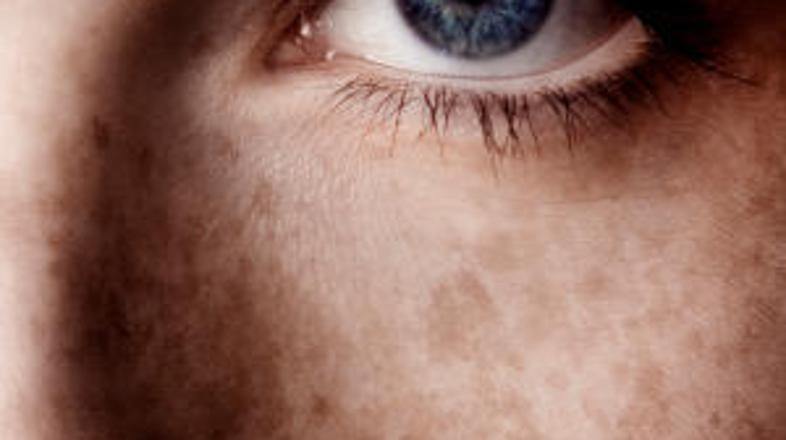 Vohate? Nevarnost pred vami.