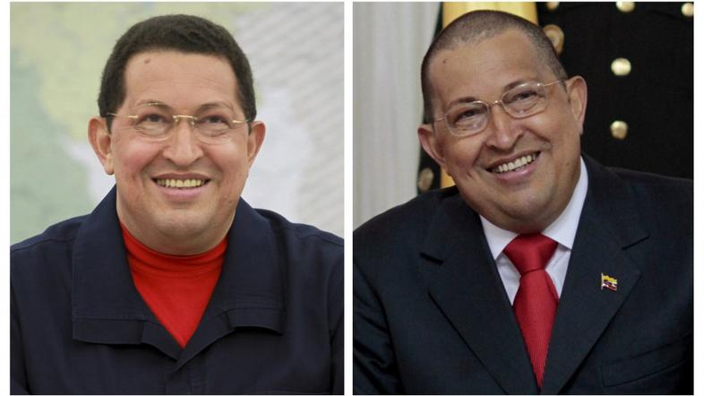 Hugo Chavez