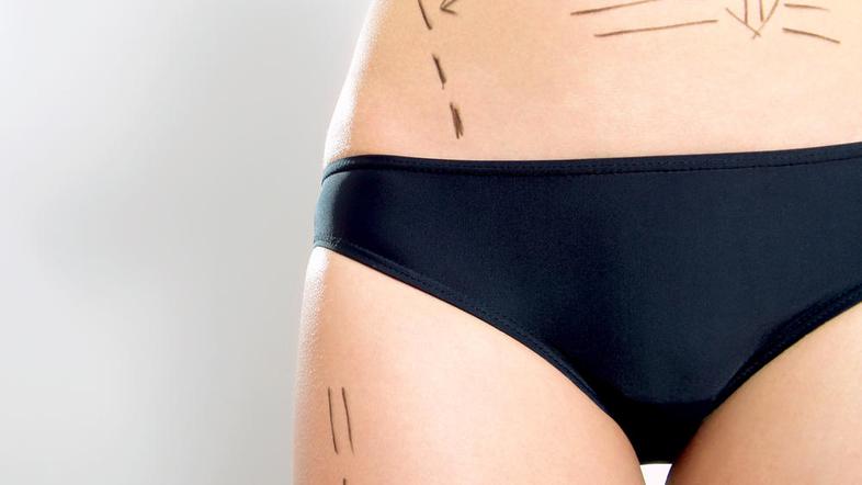 Za popravke je jesen še pravi čas.