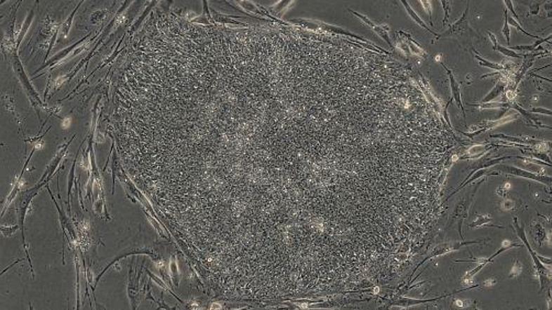Fotografija prikazuje genetske spremembe kožnih celic, ki so se posrečile znanst