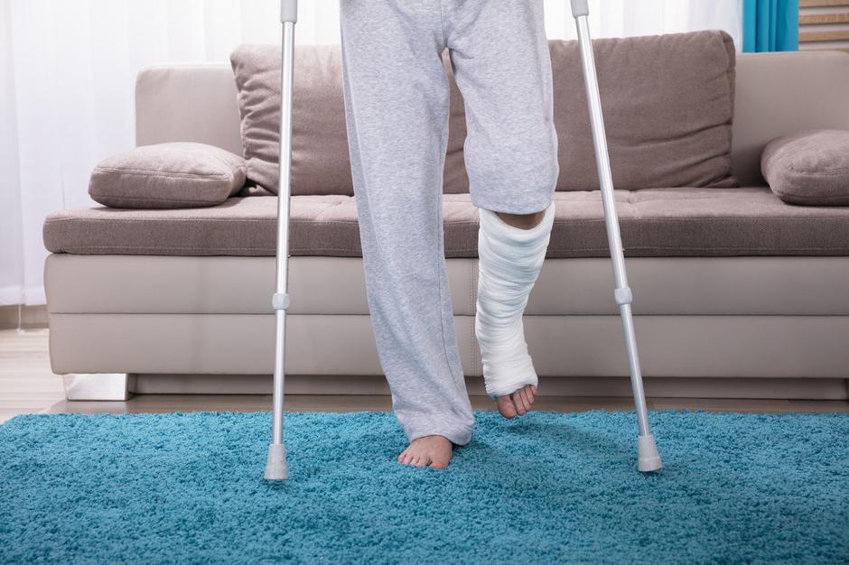 Zlom noge | Avtor: Profimedia